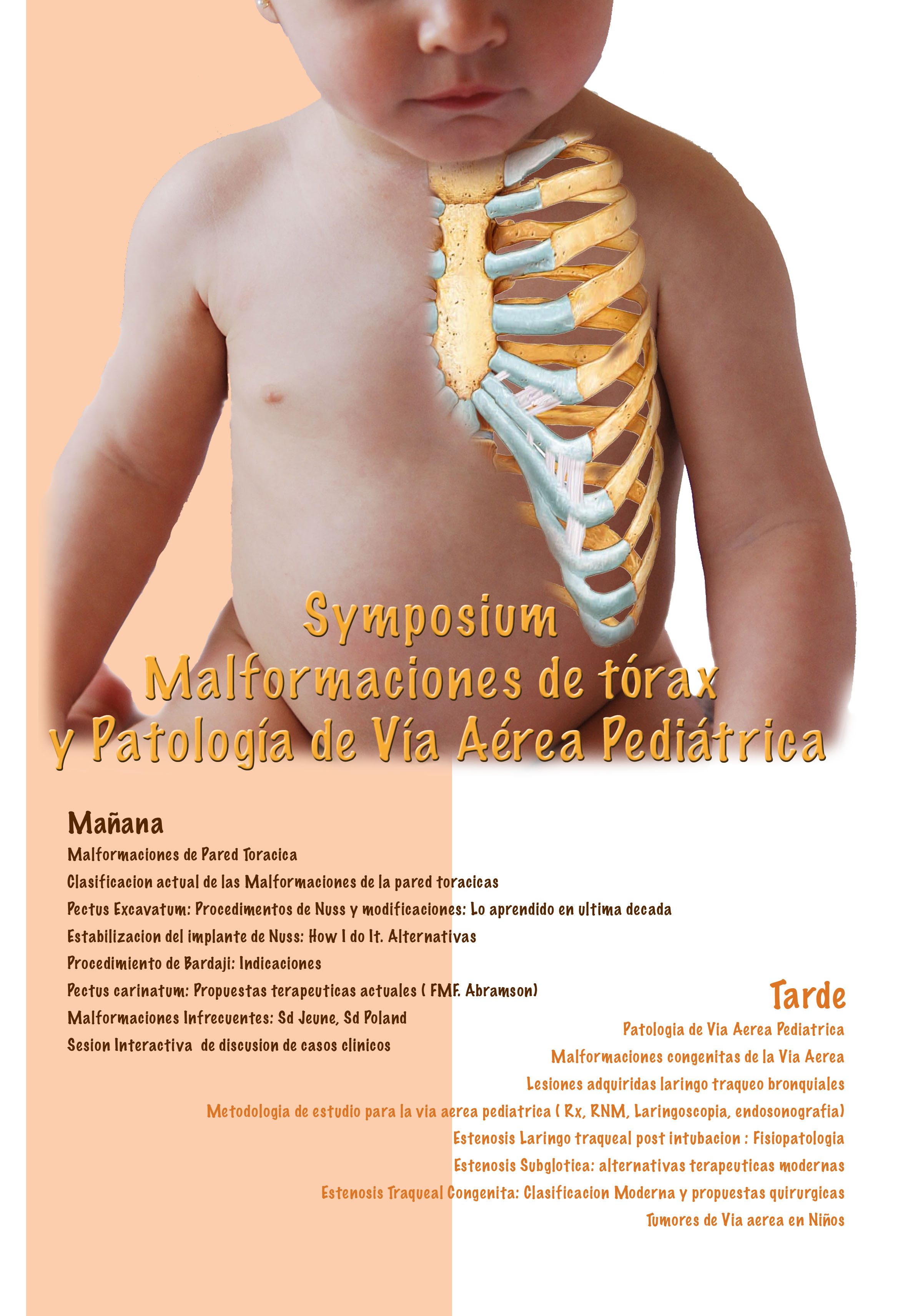 Symposium Malformaciones de tórax y Patología de vía Aérea Pediátrica